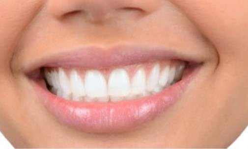 Teeth in a day